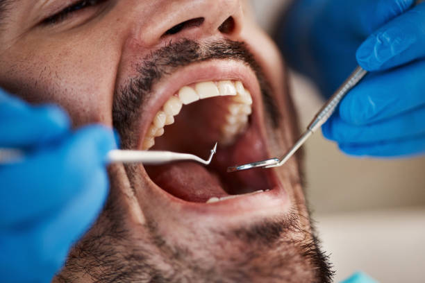 Best Urgent Dental Care for Toothache in Middle Valley, TN