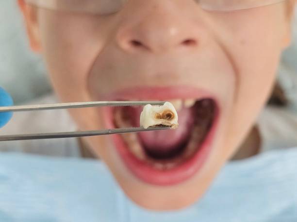 Best Emergency Dental Care for Abscessed Tooth in Middle Valley, TN